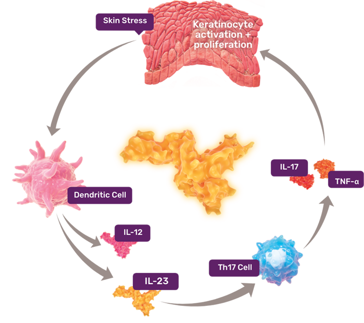 Psoriasis immune pathway showing inflammatory cytokines
